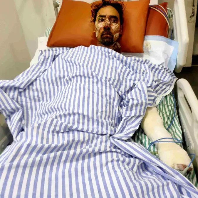 Hisar News: जिंदल रोलिंग मिल में बॉयलर में ब्लास्ट 2026